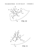 MEDICAL FLUID DELIVERY SYSTEM diagram and image