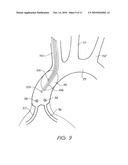 Peripheral Access Devices and Systems diagram and image