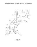 Peripheral Access Devices and Systems diagram and image