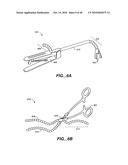 ARTICULATING CATHETERS diagram and image