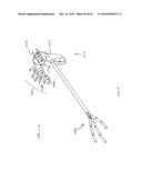 ARTICULATING CATHETERS diagram and image