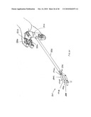 ARTICULATING CATHETERS diagram and image