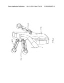 ARTICULATING CATHETERS diagram and image