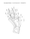 ARTICULATING CATHETERS diagram and image