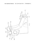 ARTICULATING CATHETERS diagram and image