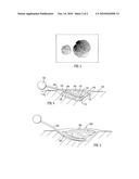 WOUND PACKING MEMBERS diagram and image