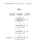 System and Method for Selecting Follicular Units for Harvesting diagram and image