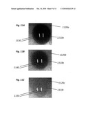 System and Method for Selecting Follicular Units for Harvesting diagram and image