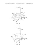 INTEGRAL ELECTRODE PLACEMENT AND CONNECTION SYSTEMS diagram and image