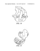 PROCESS FOR PRODUCING TOOLS USED IN ORTHOPEDIC SURGERIES diagram and image