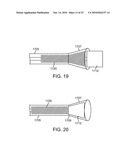 Methods and Systems for Loading a Stent diagram and image