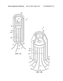 MINIMALLY INVASIVE INSTRUMENT AND METHODS TO TREAT PERIODONTAL DISEASE diagram and image