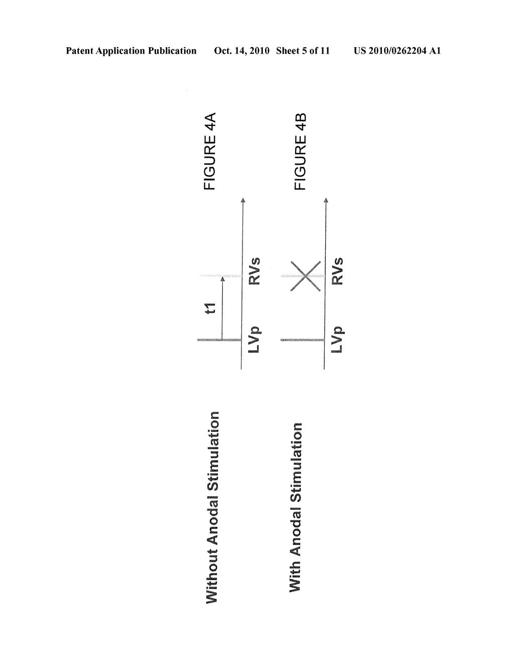 Anodal Stimulation Detection and Avoidance - diagram, schematic, and image 06