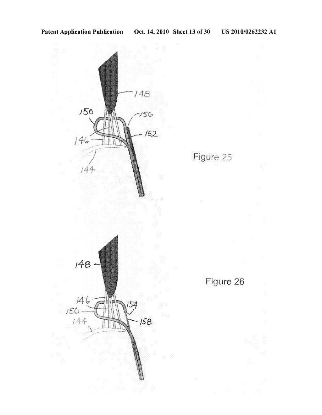 Implantable scaffolding containing an orifice for use with a prosthetic or bio-prosthetic valve - diagram, schematic, and image 14