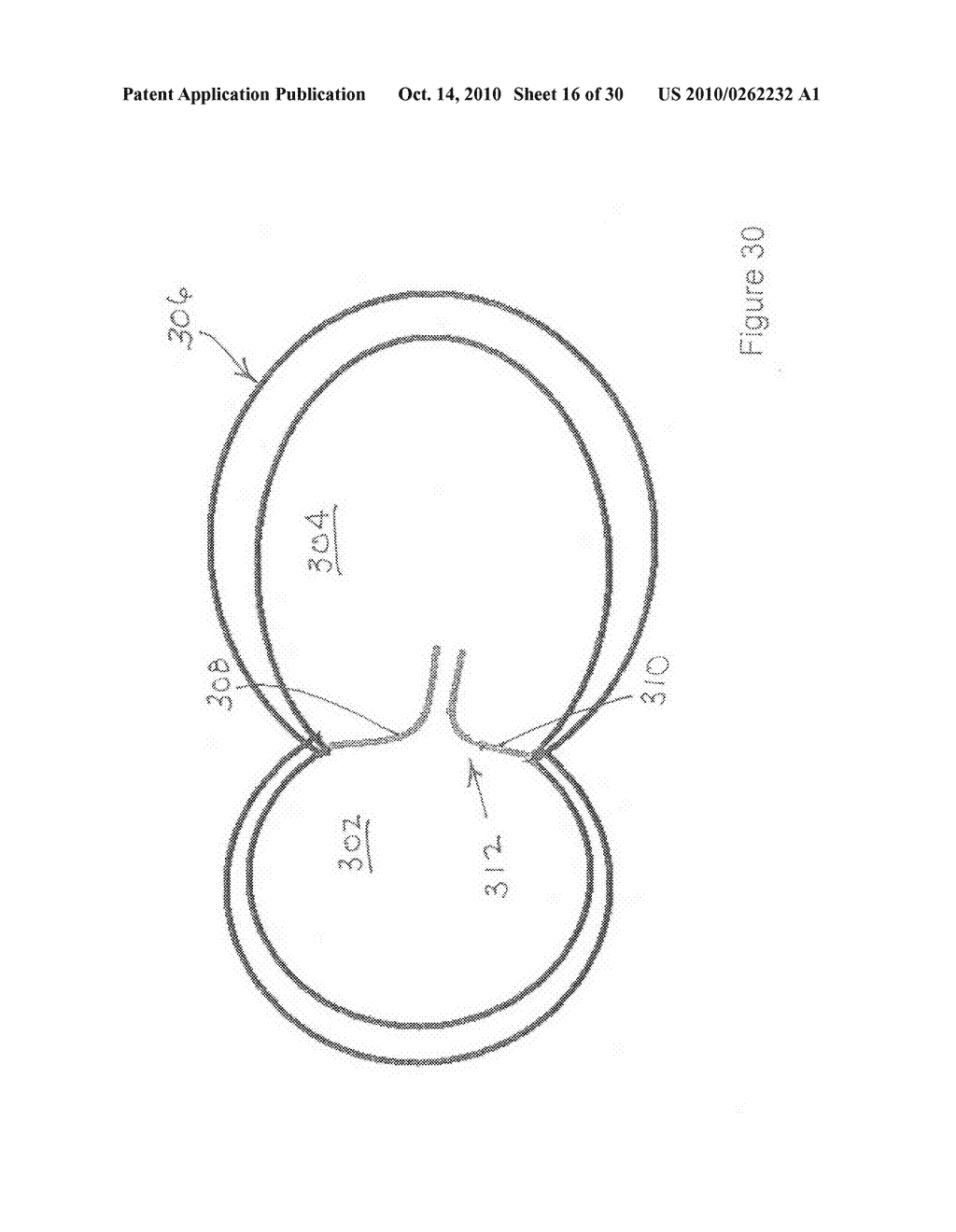 Implantable scaffolding containing an orifice for use with a prosthetic or bio-prosthetic valve - diagram, schematic, and image 17