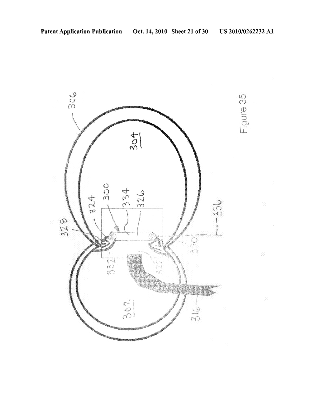 Implantable scaffolding containing an orifice for use with a prosthetic or bio-prosthetic valve - diagram, schematic, and image 22