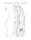 SHOE diagram and image