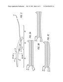 SHOE diagram and image