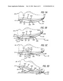 SHOE diagram and image