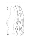 SHOE diagram and image