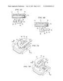 Oral Appliance for Treating a Breathing Condition diagram and image