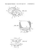 Oral Appliance for Treating a Breathing Condition diagram and image