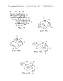 Oral Appliance for Treating a Breathing Condition diagram and image