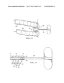 Oral Appliance for Treating a Breathing Condition diagram and image