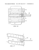 Oral Appliance for Treating a Breathing Condition diagram and image