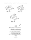 Oral Appliance for Treating a Breathing Condition diagram and image