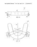 Oral Appliance for Treating a Breathing Condition diagram and image