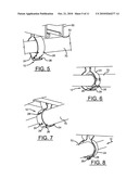 PIPE HANGER diagram and image