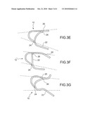 CROSS-MEMBER FOR A TWIST-BEAM AXLE REAR SUSPENSION FOR A MOTOR VEHICLE diagram and image