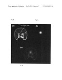 IRON-FREE VARIABLE TORQUE MOTOR COMPATIBLE WITH MAGNETIC RESONANCE IMAGING IN INTEGRATED SPECT AND MR IMAGING diagram and image