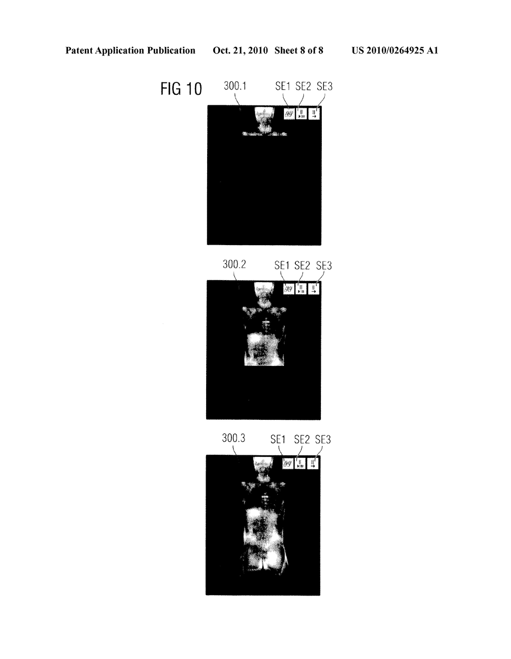 MAGNETIC RESONANCE METHOD AND APPARATUS FOR ACQUIRING MEASUREMENT DATA FROM A SUBJECT CONTINUOUSLY MOVING THROUGH THE APPARATUS - diagram, schematic, and image 09