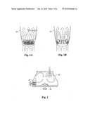 POLYETHYLENE GLYCOL-COATED SODIUM CARBONATE AS A PHARMACEUTICAL EXCIPIENT AND COMPOSITIONS PRODUCED FROM THE SAME diagram and image