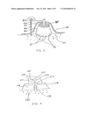 EXPANDABLE DEVICES AND METHODS FOR TISSUE EXPANSION, REGENERATION AND FIXATION diagram and image