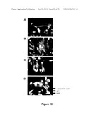 METHODS FOR ISOLATING VERY SMALL EMBRYONIC-LIKE (VSEL) STEM CELLS diagram and image