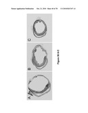 METHODS FOR ISOLATING VERY SMALL EMBRYONIC-LIKE (VSEL) STEM CELLS diagram and image