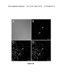 METHODS FOR ISOLATING VERY SMALL EMBRYONIC-LIKE (VSEL) STEM CELLS diagram and image