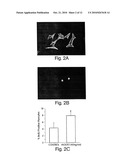 Methods for treating congestive heart failure diagram and image