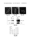 Methods for treating congestive heart failure diagram and image