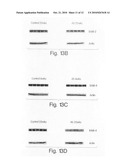 Methods for treating congestive heart failure diagram and image