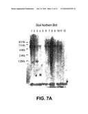 SLO2 and SLO4, Novel Potassium Channel Proteins from Human Brain diagram and image