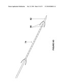 BRACHYTHERAPY FIDUCIAL NEEDLE FIXATION SYSTEM AND METHOD diagram and image