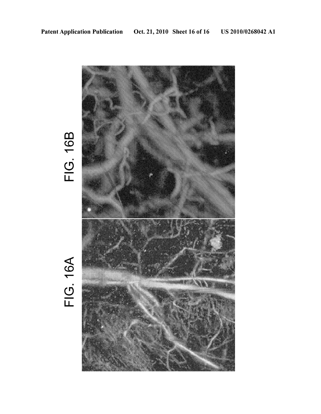 CONFOCAL PHOTOACOUSTIC MICROSCOPY WITH OPTICAL LATERAL RESOLUTION - diagram, schematic, and image 17