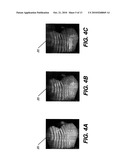 DENTAL SURFACE IMAGING USING POLARIZED FRINGE PROJECTION diagram and image