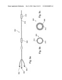 METHODS AND APPARATUSES FOR VASCULAR AND PROSTATE TREATMENT diagram and image