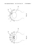 MULTIMODE ULTRASOUND FOCUSING FOR MEDICAL APPLICATIONS diagram and image