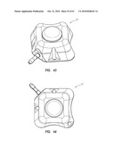 SYSTEMS AND METHODS FOR RADIOGRAPHICALLY IDENTIFYING AN ACCESS PORT diagram and image